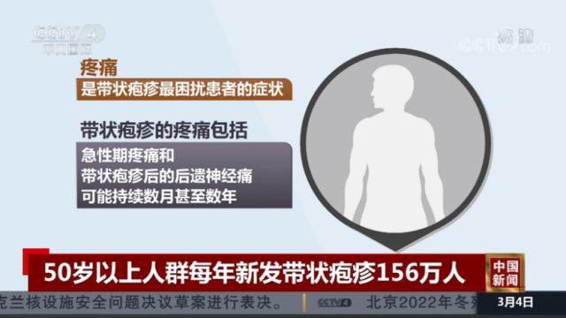 又到暑湿季，壮医三招有效治疗带状疱疹