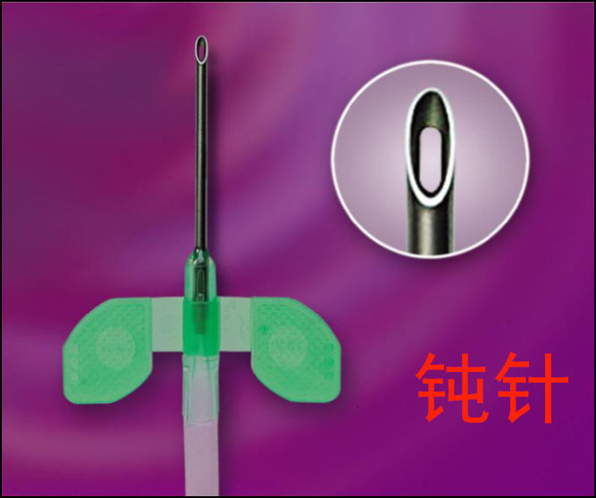 我院率先开展动静脉内瘘钝针扣眼穿刺术