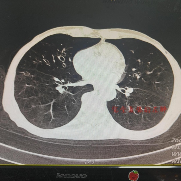 619c84b0b39491213cd7c30ce8eb06a9