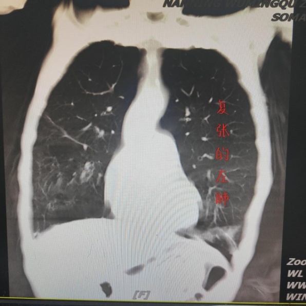 b005a69f9f17c9c8855c1ce2b2ea2b1d