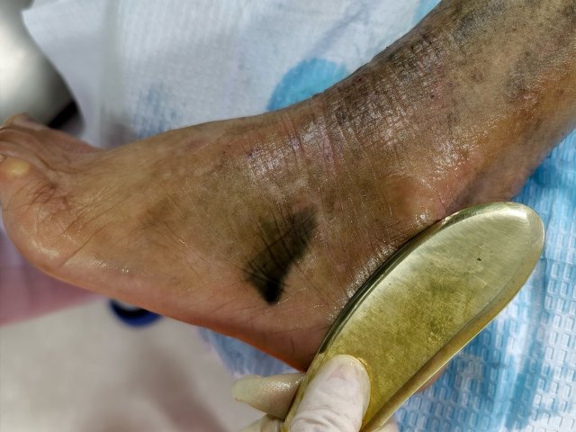 第一次挂出黑砂2.jpg